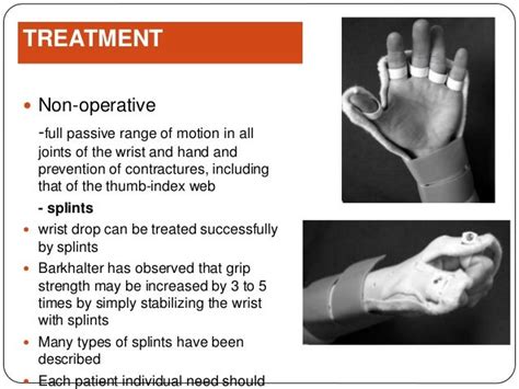 Radial Nerve Palsy