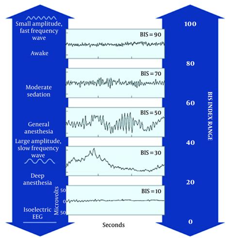 A Review of Bispectral Index Utility in Neurocritical Care Patients | Archives of Neuroscience ...