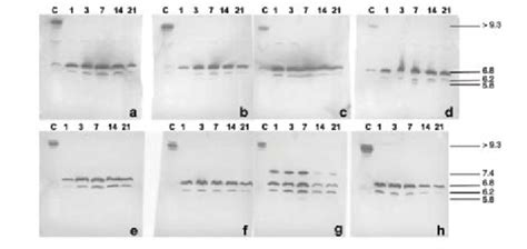 Serum amyloid A isoforms by denaturing isoelectric focusing and Western... | Download High ...