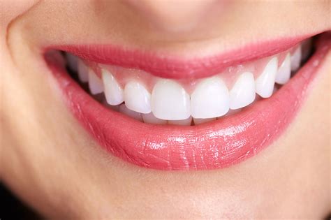 Tipos de sonrisa - JM Arizala | Dentista en Donostia