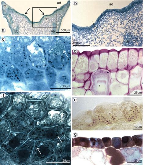 Histochemical features of the lip of B. weberi.a Transverse section:... | Download Scientific ...