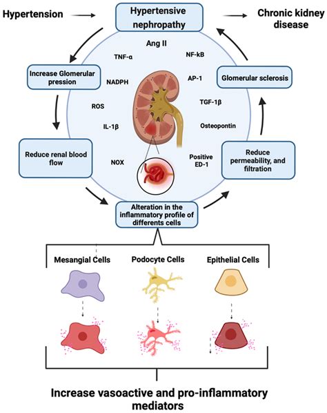 IJMS | Free Full-Text | Hypertensive Nephropathy: Unveiling the ...