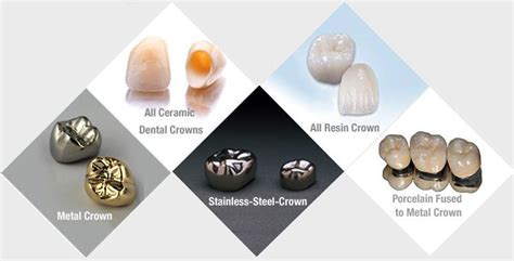 Dental Crowns and Caps in Hyderabad | Dental Crowns in Hyderabad