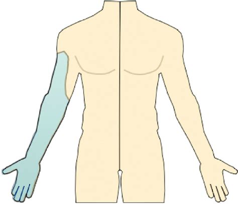 Axillary Nerve Block Anatomical Distribution. | Download Scientific Diagram