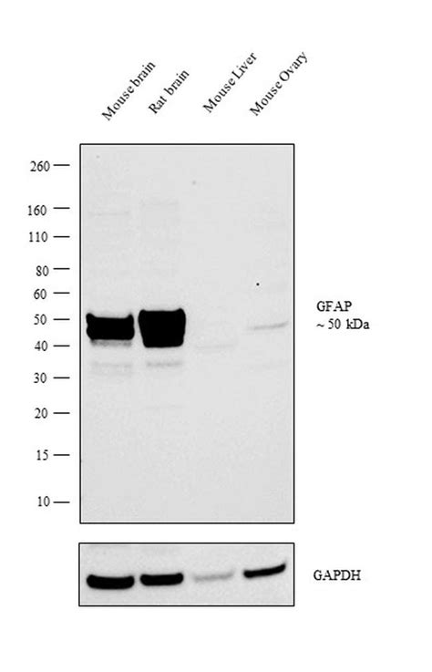 GFAP Antibody (PA5-18598)