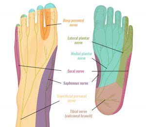 Medial Calcaneal Nerve Entrapment - Symptoms & Treatment