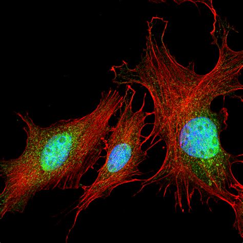 Immunofluorescence Troubleshooting- Protocol Tips | StressMarq Biosciences Inc.