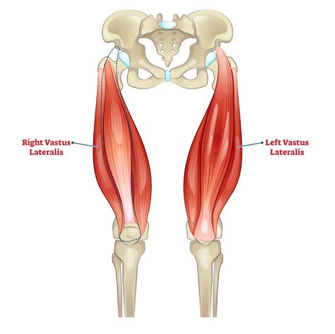 Vastus Medialis Muscle Exercises