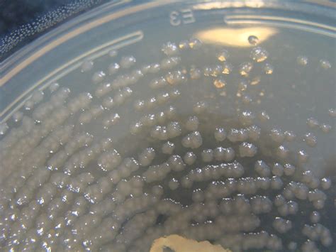 Pseudomonas aeruginosa on ChromID CPS Agar - Detail | Flickr