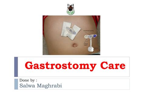 PPT - Gastrostomy Care PowerPoint Presentation, free download - ID:4497125