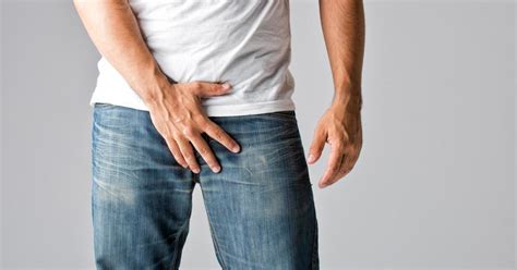 What Is Balanitis: Causes, Symptoms, Treatment, and Prevention