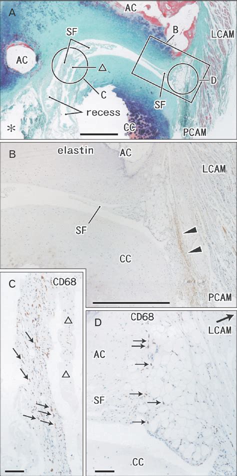 Figure 2 from Synovial tissue morphology of the cricoarytenoid joint in ...