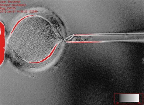 Scientists use cloning to make stem cells matched to two adults - Los ...