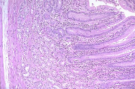 Fundus Histology