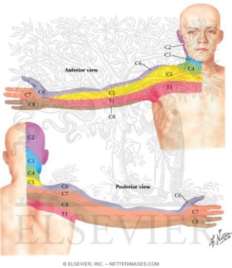 Cervical Dermatome Map http://www.netterimages.com/images/vpv/000/000 ...