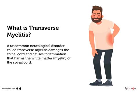 Transverse Myelitis: Treatment, Procedure, Cost, Recovery, Side Effects And More