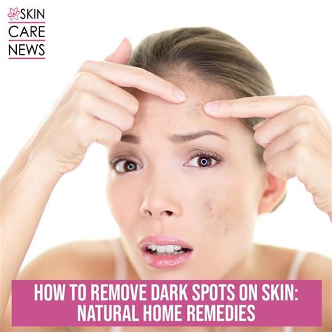 How To Remove Dark spots On Skin: Natural Home Remedies - Skin Care Top News