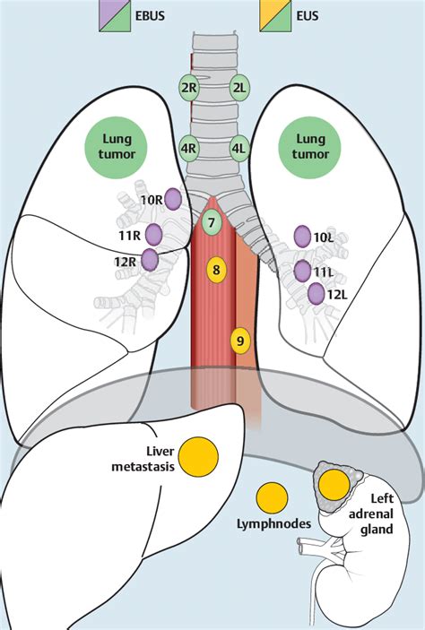 Hilar Lymph Nodes Map