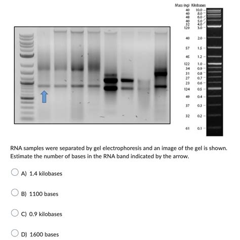 Solved RNA samples were separated by gel electrophoresis and | Chegg.com