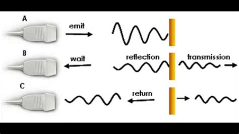 Ultrasound B-Mode Image Reconstruction - YouTube