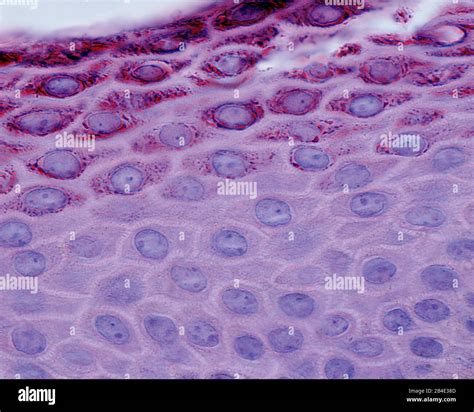 Strato Di Spinoso Immagini e Fotos Stock - Alamy