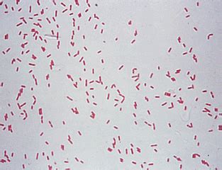 Pseudomonas aeruginosa ~ Examination and Happiness