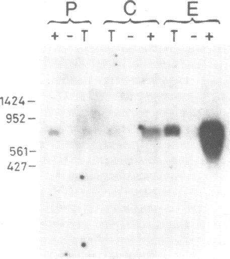 Northern blot hybridization analysis of total RNA (T), polyA(-) RNA (-)... | Download Scientific ...