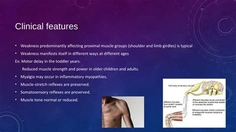 Proximal myopathy and causes