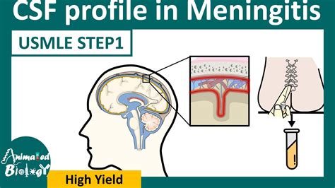 CSF analysis in Meningitis | Easy way to remember CSF analysis in meningitis (flow chart) - YouTube