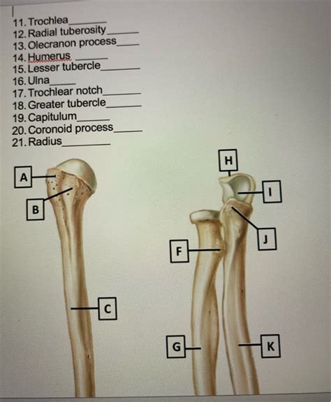 Solved 11. Trochlea 12. Radial tuberosity 13. Olecranon | Chegg.com