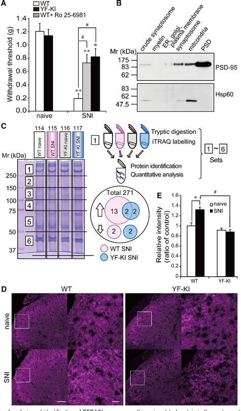 Figure 1 from Involvement of Brain-Enriched Guanylate Kinase-Associated ...