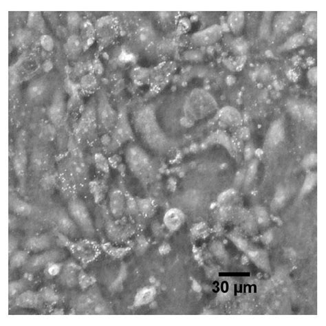 Image comparison during Plasmocin treatment. This series of images... | Download Scientific Diagram