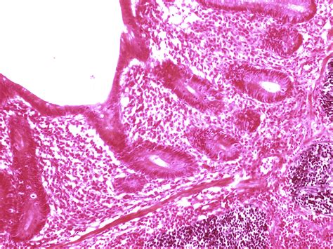 Appendix Histology Slides Labeled