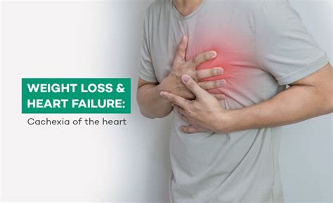 Weight loss and heart failure: Cachexia of the heart