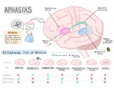 neurology Archives | maidoodles #neuro #aphasia in 2020 | Aphasia ...