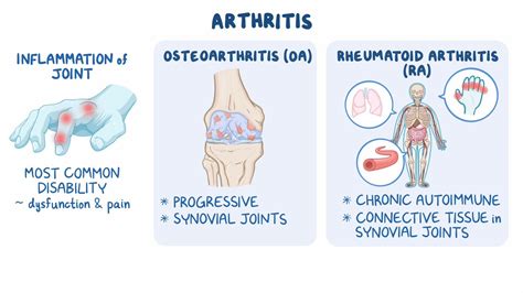 Nursing Care for Arthritis - Osmosis Video Library