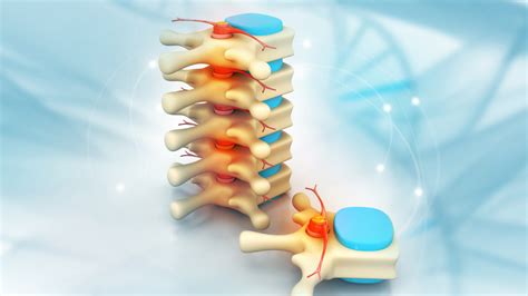 Nerve Blocks for Pain Management - Pontchartrain Orthopedics & Sports Medicine