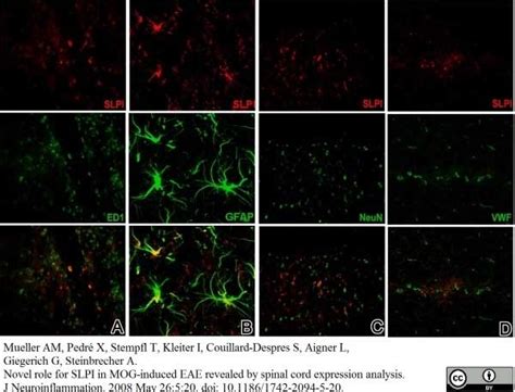 Anti Human von Willebrand Factor Antibody | Bio-Rad