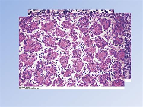 PPT - Thymus and Thymoma PowerPoint Presentation - ID:429921