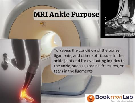 MRI Ankle: Price, Purpose, Procedure & Results [2024] • Bookmerilab