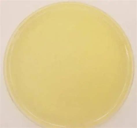 Nutrient Agar: Composition, Preparation, Uses • Microbe Online