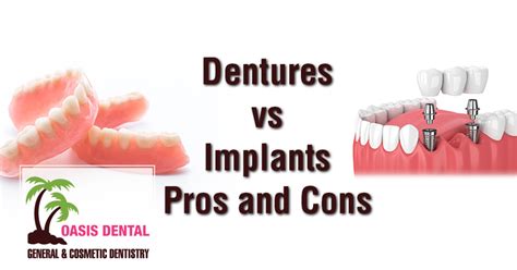 Dentures vs Implants Pros and Cons - Oasis Dental Blog - Oasis Dental