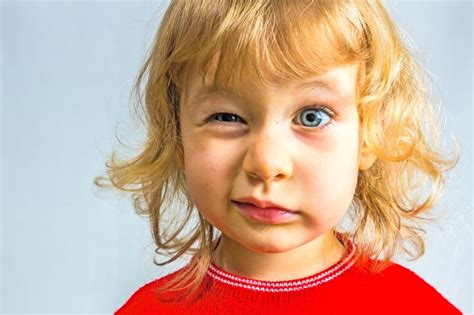 Itchy, red eyes: Infection or allergies? | Salud infantil, Salud, Niños