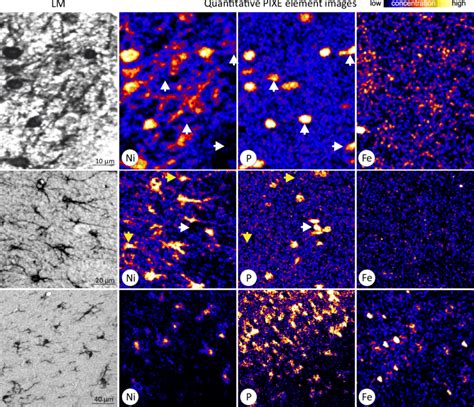 Element maps of glial cells. Light microscopy (LM) and element images ...