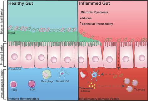 Frontiers | Healthy Gut, Healthy Bones: Targeting the Gut Microbiome to Promote Bone Health