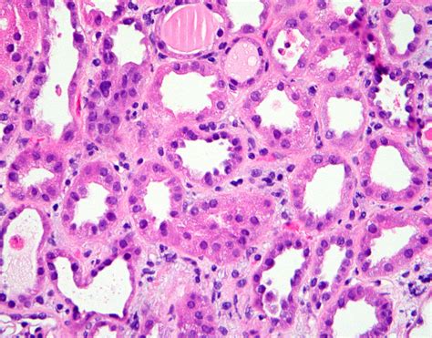 Renal Tubule Histology