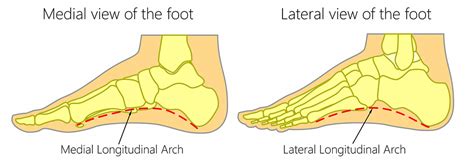 Pronated or Supinated ? Foot Pronation Type | Shapecrunch