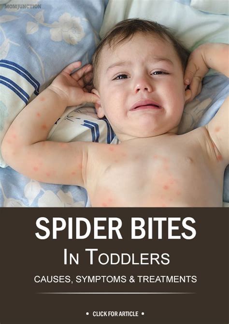 Spider Bites In Toddlers: Facts, Symptoms & Ways To Prevent | Dairy intolerance symptoms, Spider ...