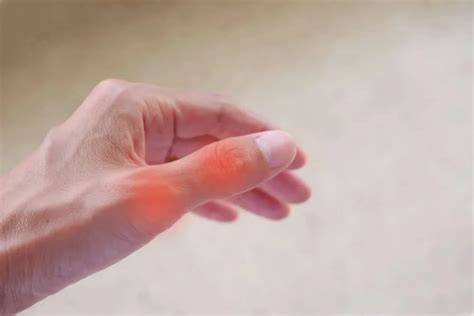 Thumb Joint Pain: Causes, Symptoms And Treatment - DACORM Massage Gun