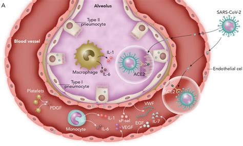 Confronting the controversy: Interleukin-6 and the COVID-19 cytokine ...